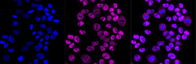 RING1 Antibody in Immunocytochemistry (ICC/IF)
