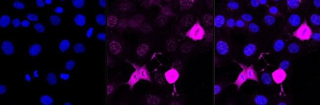 Phospho-PKC alpha (Ser657) Antibody in Immunocytochemistry (ICC/IF)
