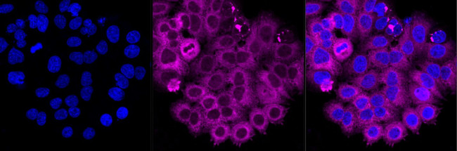 RRM1 Antibody in Immunocytochemistry (ICC/IF)