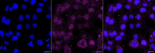 Caspase 3 Antibody in Immunocytochemistry (ICC/IF)