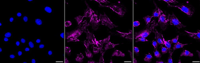 ITGA5 Antibody in Immunocytochemistry (ICC/IF)
