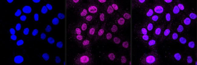 Cullin 1 Antibody in Immunocytochemistry (ICC/IF)