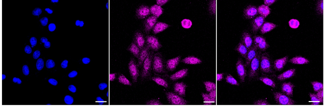 NUMB Antibody in Immunocytochemistry (ICC/IF)