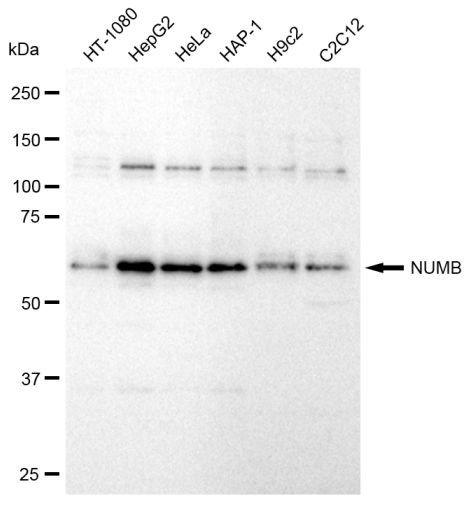 NUMB Antibody in Western Blot (WB)