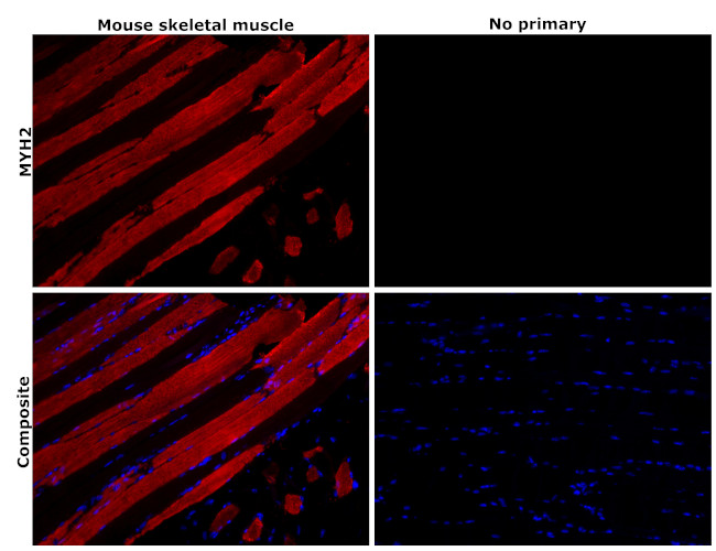 MYH2 Antibody in Immunohistochemistry (Paraffin) (IHC (P))