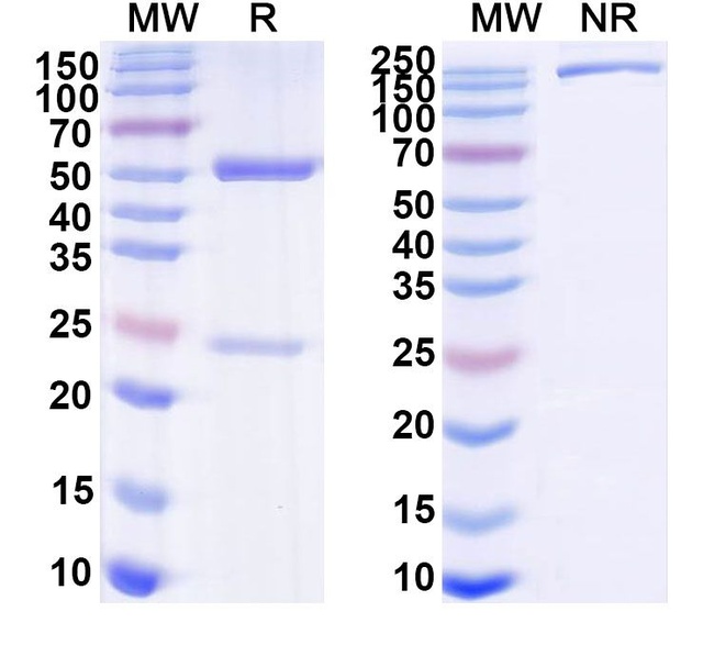 Lassa Virus Glycoprotein G1 (Biosimilar) Antibody in SDS-PAGE (SDS-PAGE)
