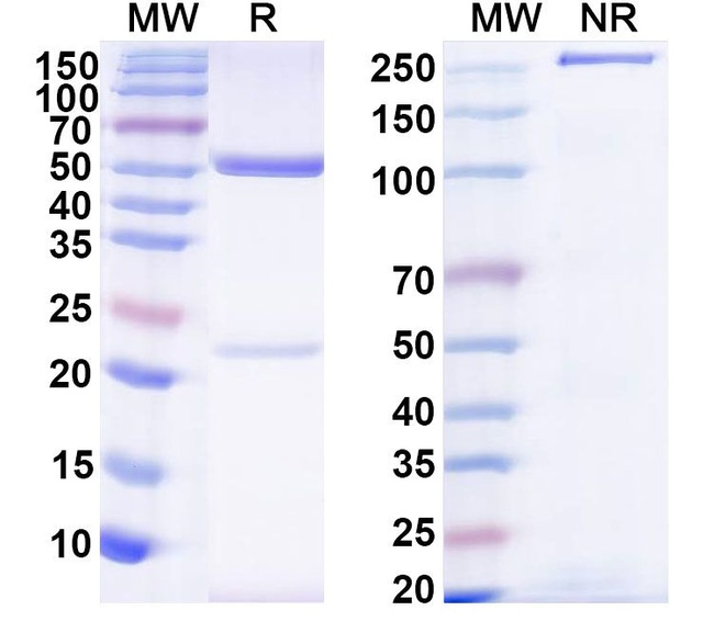 Staphylococcus aureus Protein A (Omodenbamab Biosimilar) Antibody in SDS-PAGE (SDS-PAGE)