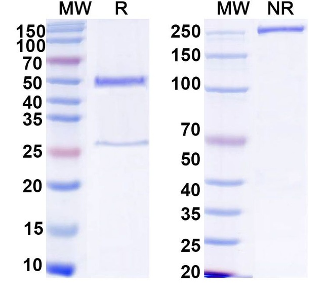 Human IgG1 Isotype Control in SDS-PAGE (SDS-PAGE)