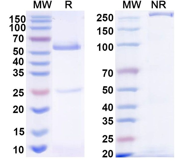 Human IgG1, kappa Isotype Control in SDS-PAGE (SDS-PAGE)