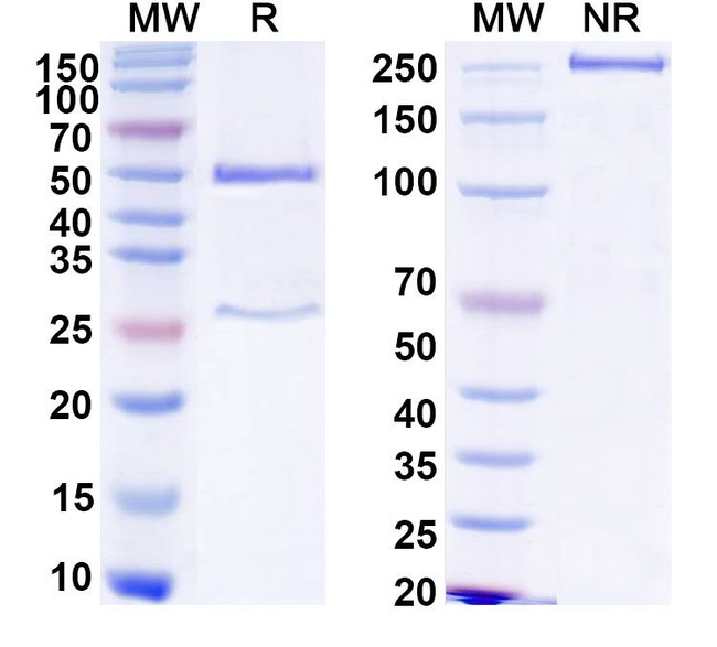 Human IgG1 Isotype Control in SDS-PAGE (SDS-PAGE)