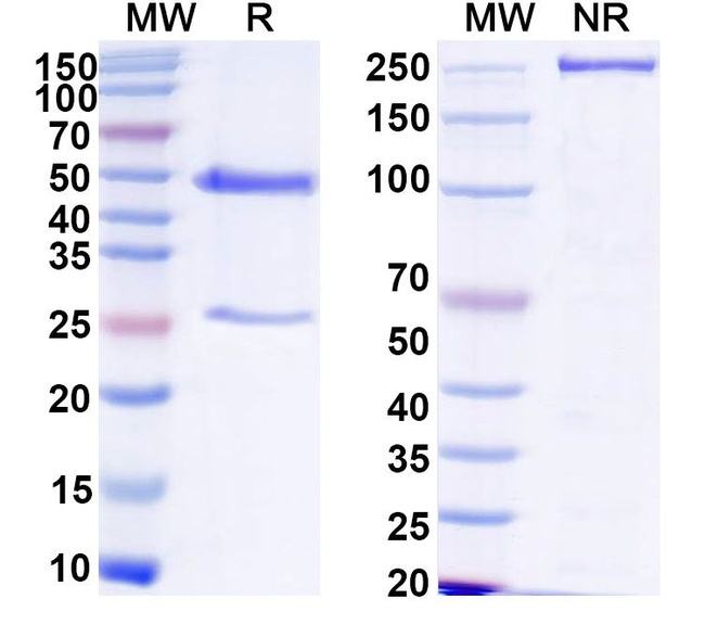 Human IgG1 Isotype Control in SDS-PAGE (SDS-PAGE)