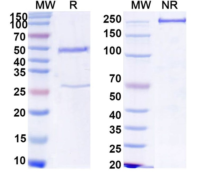 Human IgG2 Isotype Control in SDS-PAGE (SDS-PAGE)