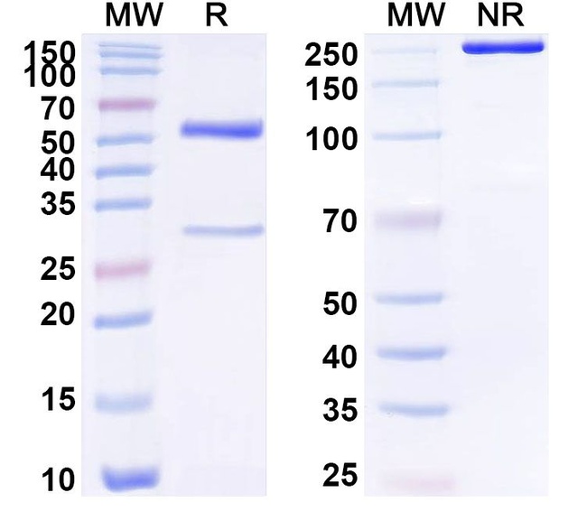 Human IgG2 lambda Isotype Control in SDS-PAGE (SDS-PAGE)