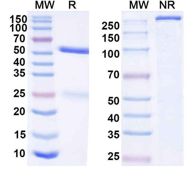 Human IgG4 (S228P) Isotype Control in SDS-PAGE (SDS-PAGE)