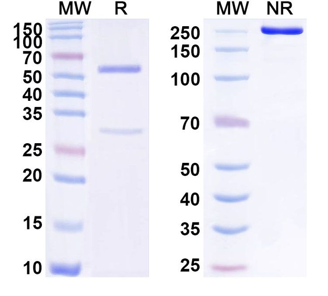 Human IgG4 (S228P, R409K) kappa Isotype Control in SDS-PAGE (SDS-PAGE)