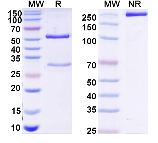 Mouse IgG1 Isotype Control in SDS-PAGE (SDS-PAGE)