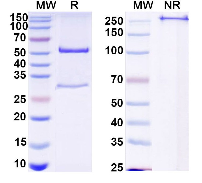 Mouse IgG2a Isotype Control in SDS-PAGE (SDS-PAGE)