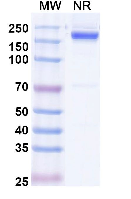 Rabbit IgG Isotype Control in SDS-PAGE (SDS-PAGE)