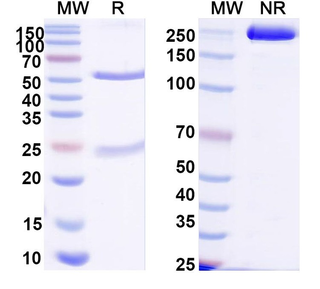 Rat IgG2a Isotype Control in SDS-PAGE (SDS-PAGE)