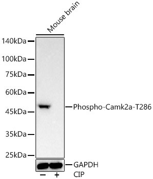 Phospho-CaMKII alpha (Thr286) Antibody in Western Blot (WB)
