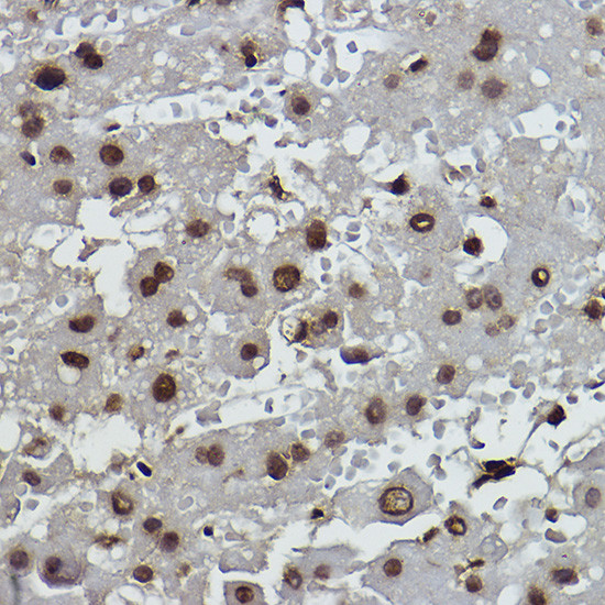 Formyl-Histone H2B (Lys108) Antibody in Immunohistochemistry (Paraffin) (IHC (P))