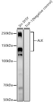 ALK Antibody in Western Blot (WB)