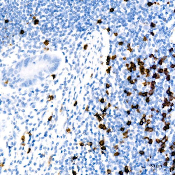 CD8 Antibody in Immunohistochemistry (Paraffin) (IHC (P))
