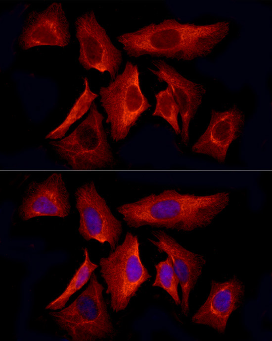 Cytokeratin 8 Antibody in Immunocytochemistry (ICC/IF)