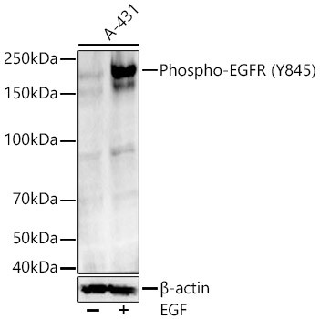 Phospho-EGFR (Tyr845) Antibody in Western Blot (WB)