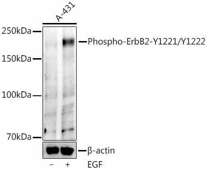 Phospho-ErbB2 (HER-2) (Tyr1221, Tyr1222) Antibody in Western Blot (WB)