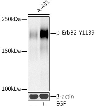 Phospho-ErbB2 (HER-2) (Tyr1139) Antibody in Western Blot (WB)