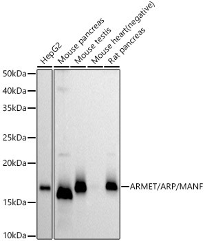 ARMET Antibody in Western Blot (WB)