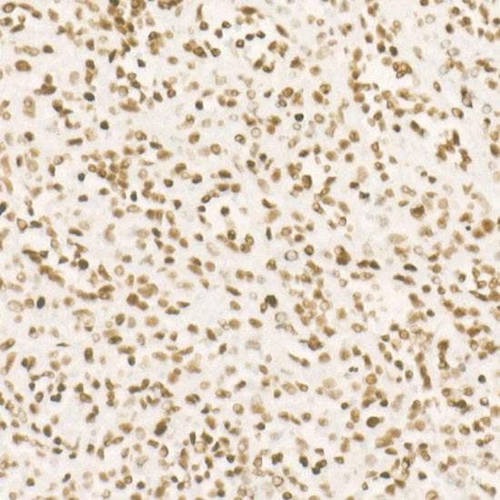 CDK12 Antibody in Immunohistochemistry (Paraffin) (IHC (P))