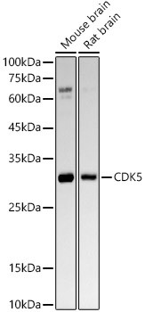 CDK5 Antibody in Western Blot (WB)