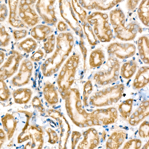 Metadherin Antibody in Immunohistochemistry (Paraffin) (IHC (P))