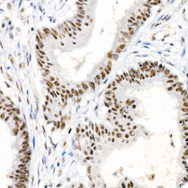 Phospho-Chk2 (Thr68) Antibody in Immunohistochemistry (Paraffin) (IHC (P))