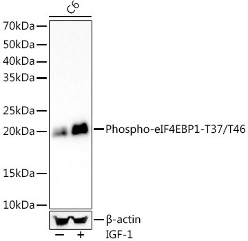 Phospho-4EBP1 (Thr37, Thr46) Antibody in Western Blot (WB)