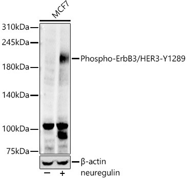 Phospho-ErbB3 (Tyr1289) Antibody in Western Blot (WB)