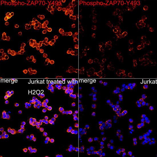 Phospho-Zap-70 (Tyr493) Antibody in Immunocytochemistry (ICC/IF)
