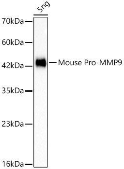 pro MMP9 Antibody in Western Blot (WB)