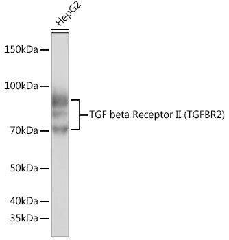 TGFBR2 Antibody in Western Blot (WB)