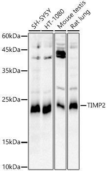 TIMP2 Antibody in Western Blot (WB)