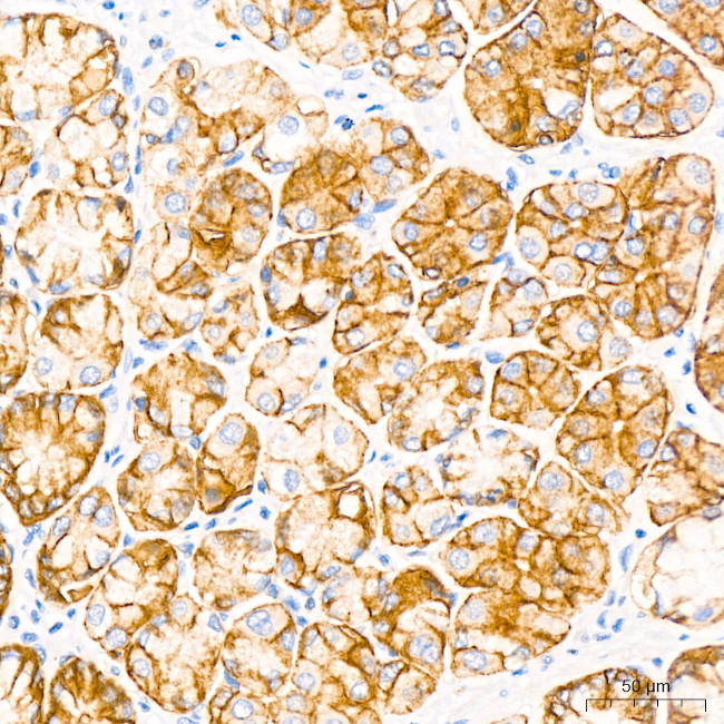 Claudin 18.2 Antibody in Immunohistochemistry (Paraffin) (IHC (P))