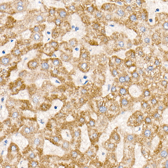 MT-ND6 Antibody in Immunohistochemistry (Paraffin) (IHC (P))