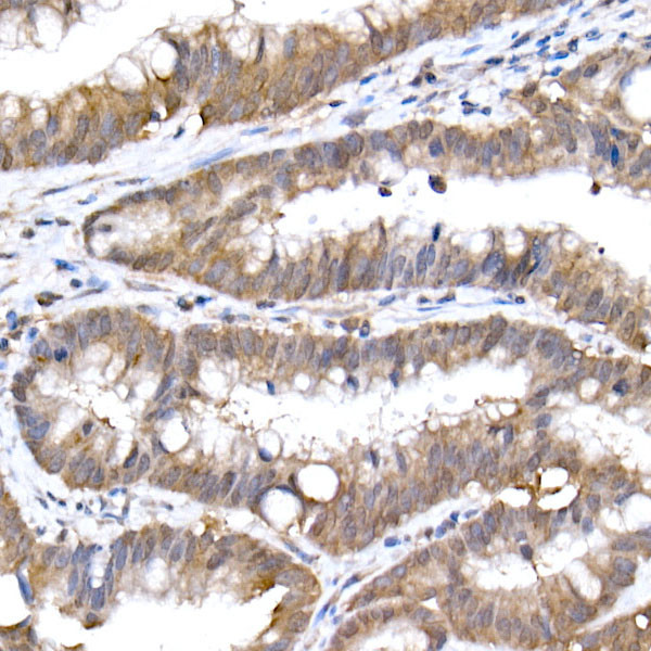 UBE2D1 Antibody in Immunohistochemistry (Paraffin) (IHC (P))
