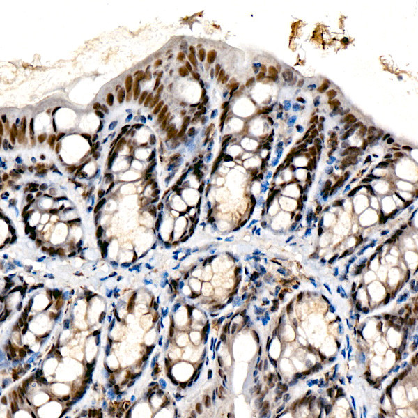 CHD1 Antibody in Immunohistochemistry (Paraffin) (IHC (P))
