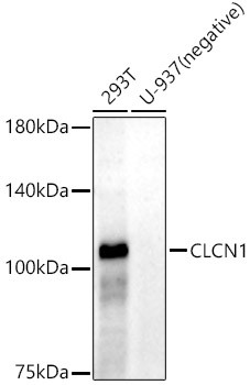 CLCN1 Antibody in Western Blot (WB)