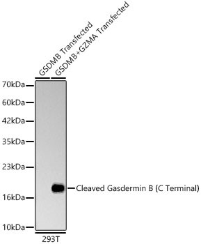 GSDMB (Cleaved) Antibody in Western Blot (WB)