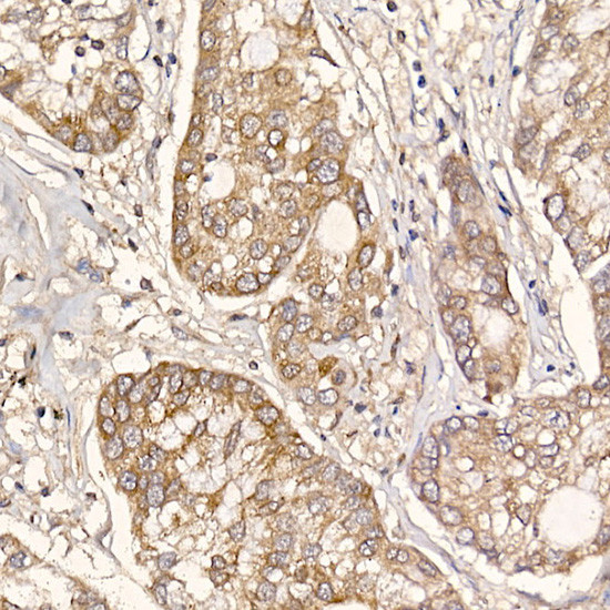 TXNDC12 Antibody in Immunohistochemistry (Paraffin) (IHC (P))