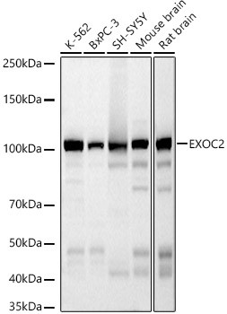 EXOC2 Antibody in Western Blot (WB)